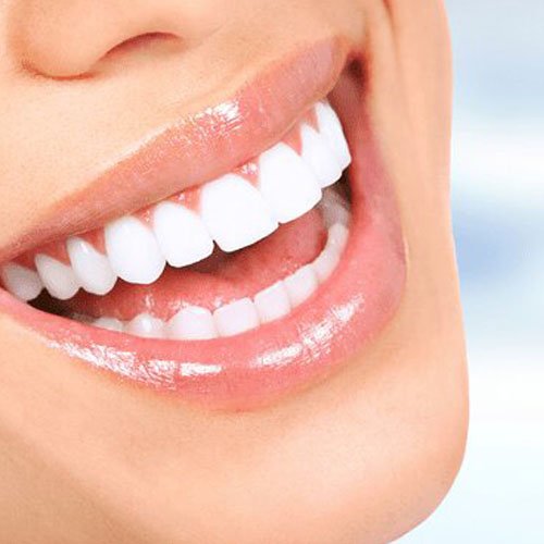 Smile Design