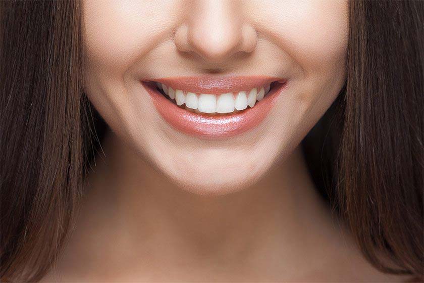 Smile Design