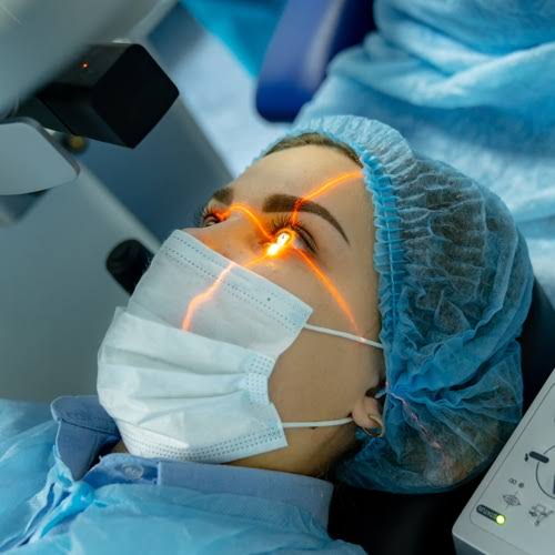 Laser Göz Müalicəsi
