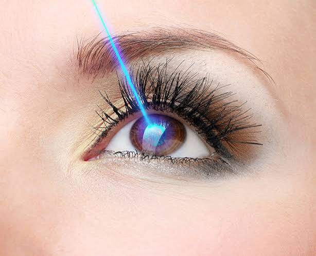 Laser Göz Müalicəsi